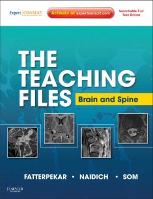 The Teaching Files Brain and Spine Imaging