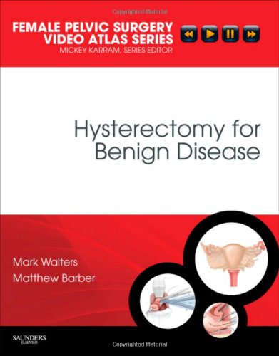 Hysterectomy for Benign Disease Female Pelvic Surgery Video Atlas Series