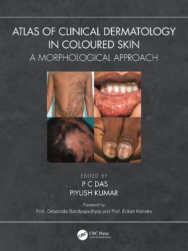 Atlas of Clinical Dermatology in Coloured Skin A Morphological Approach
