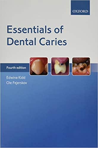 Essentials of Dental Caries 4th Edition