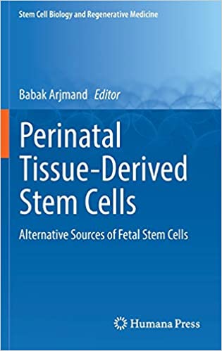 Perinatal Tissue Derived Stem Cells Alternative Sources of Fetal Stem Cells