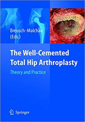 The Well Cemented Total Hip Arthroplasty Theory and Practice