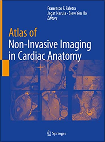 Atlas of Non Invasive Imaging in Cardiac Anatomy