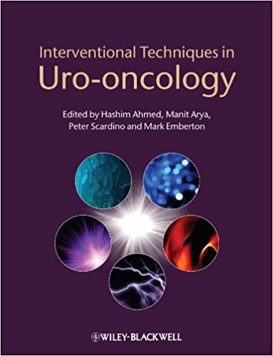Interventional Techniques in Uro Oncology