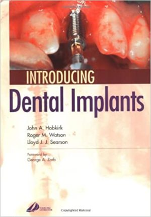 Introducing Dental Implants