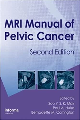 MRI Manual of Pelvic Cancer 2nd Edition