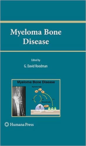 Myeloma Bone Disease