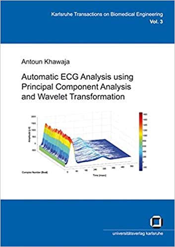 Automatic ECG Analysis using Principal Component Analysis and Wavelet Transformation