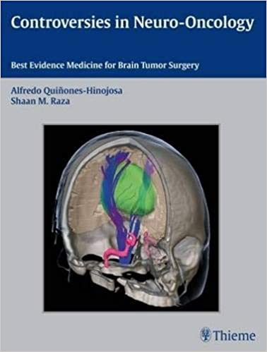 Controversies in Neuro Oncology Best Evidence Medicine for Brain Tumor Surgery