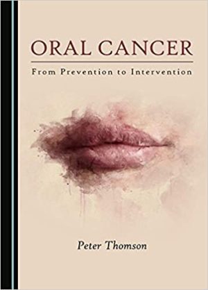 Oral Cancer From Prevention to Intervention