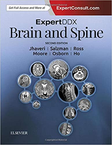 ExpertDDx Brain and Spine 2nd Ed