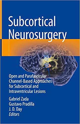 Subcortical Neurosurgery Open and Parafascicular Channel Based Approaches for Subcortical and Intraventricular Lesions