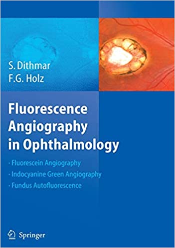 Fluorescence Angiography In Ophthalmology