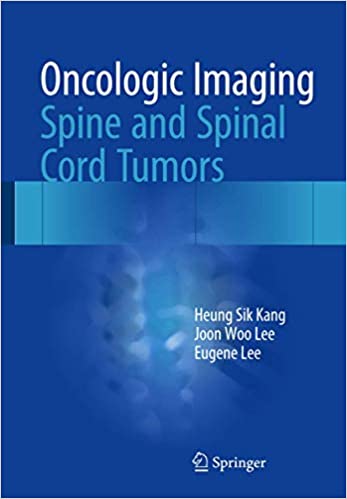 Oncologic Imaging Spine and Spinal Cord Tumors