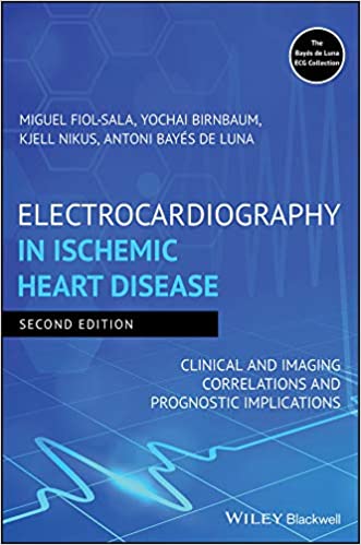 Electrocardiography in Ischemic Heart Disease Clinical and Imaging Correlations and Prognostic Implications 2nd Ed