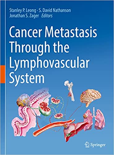 Cancer Metastasis Through the Lymphovascular System