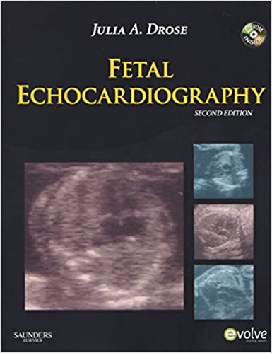 Fetal Echocardiography 2nd Edition By Julia A Drose