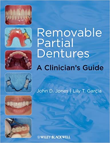 Removable Partial Dentures A Clinicians Guide