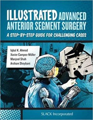Illustrated Advanced Anterior Segment Surgery A Step-by Step Guide for Challenging Cases