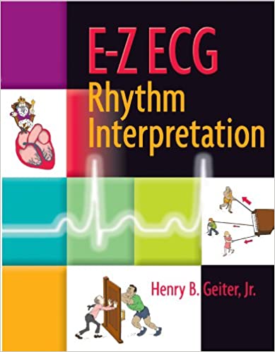 E Z ECG rhythm interpretation