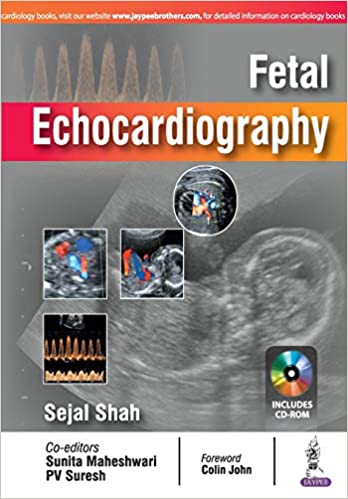 Fetal Echocardiography By Sejal Shah