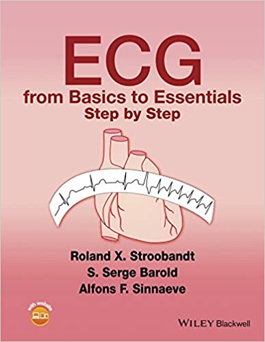 ECG from Basics to Essentials Step by Step