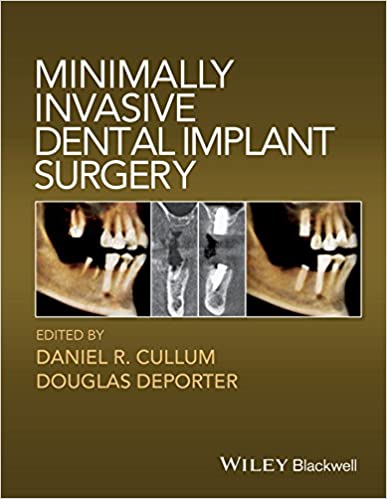 Minimally invasive Dental implant Surgery