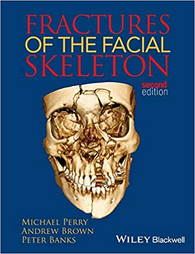 Fractures of the Facial Skeleton 2nd Edition By Peter Banks