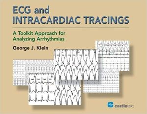 ECG and Intracardiac Tracings A Toolkit Approach for Analyzing Arrhythmias