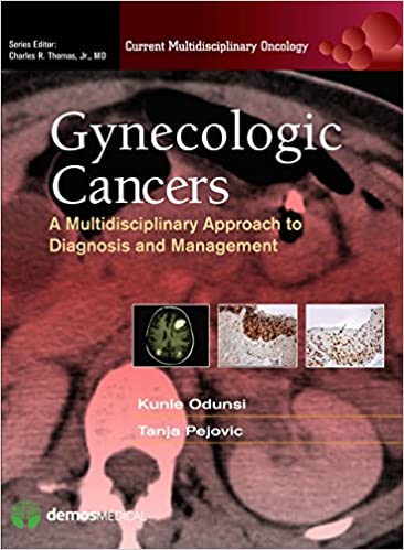 Gynecologic Cancers A Multidisciplinary Approach to Diagnosis and Management