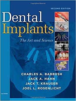 Dental Implants The Art And Science 2nd Ed