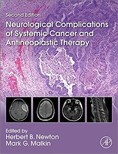 Neurological Complications of Systemic Cancer and Antineoplastic Therapy 2nd Edition