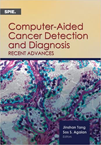 Computer Aided Cancer Detection and Diagnosis Recent Advances