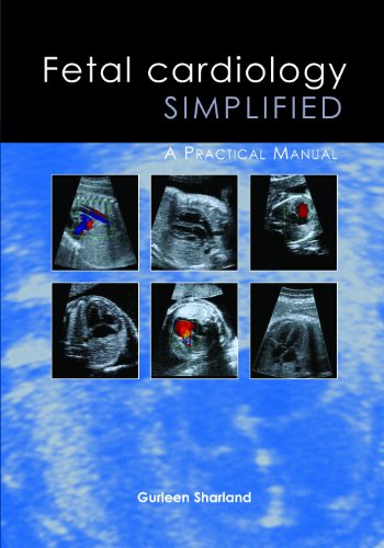 Fetal Cardiology Simplified A Practical Manual