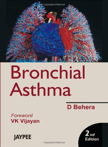 Childhood Asthma