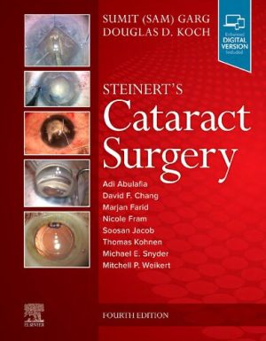 Steinerts Cataract Surgery 4th Edition