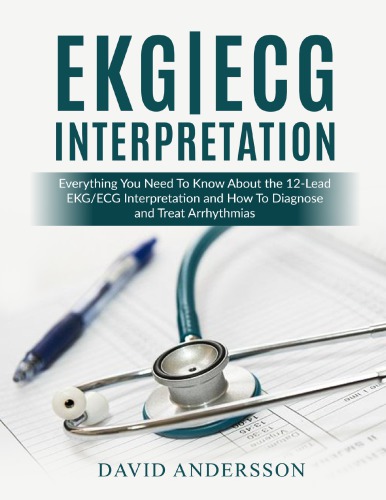 EKG ECG Interpretation Everything You Need to Know About the 12 Lead ECG EKG Interpretation and How to Diagnose and Treat Arrhythmias