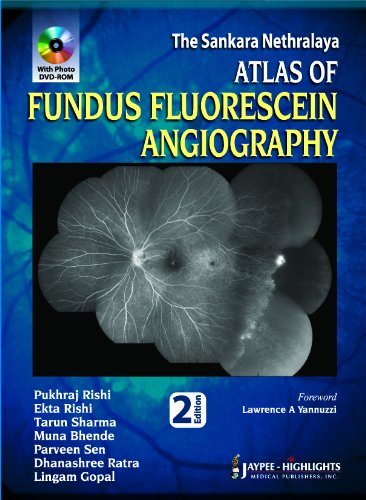 The Sankara Nethralaya Atlas of Fundus Fluorescein Angiography 2nd Ed