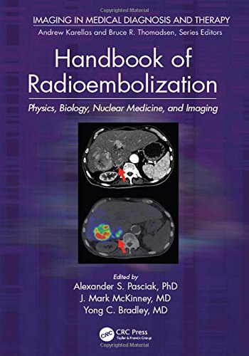 Handbook of Radioembolization Physics Biology Nuclear Medicine and Imaging