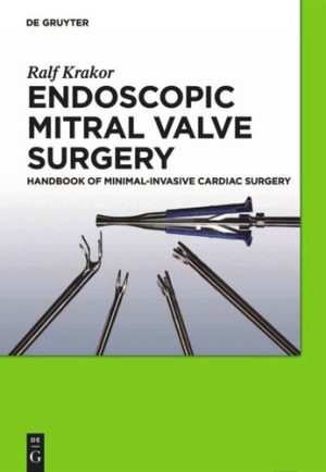 Endoscopic Mitral Valve Surgery